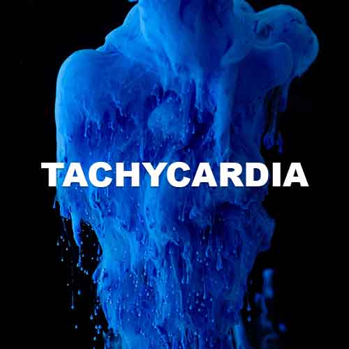 track-artwork